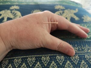 Acupuncture point Large Intestine 4